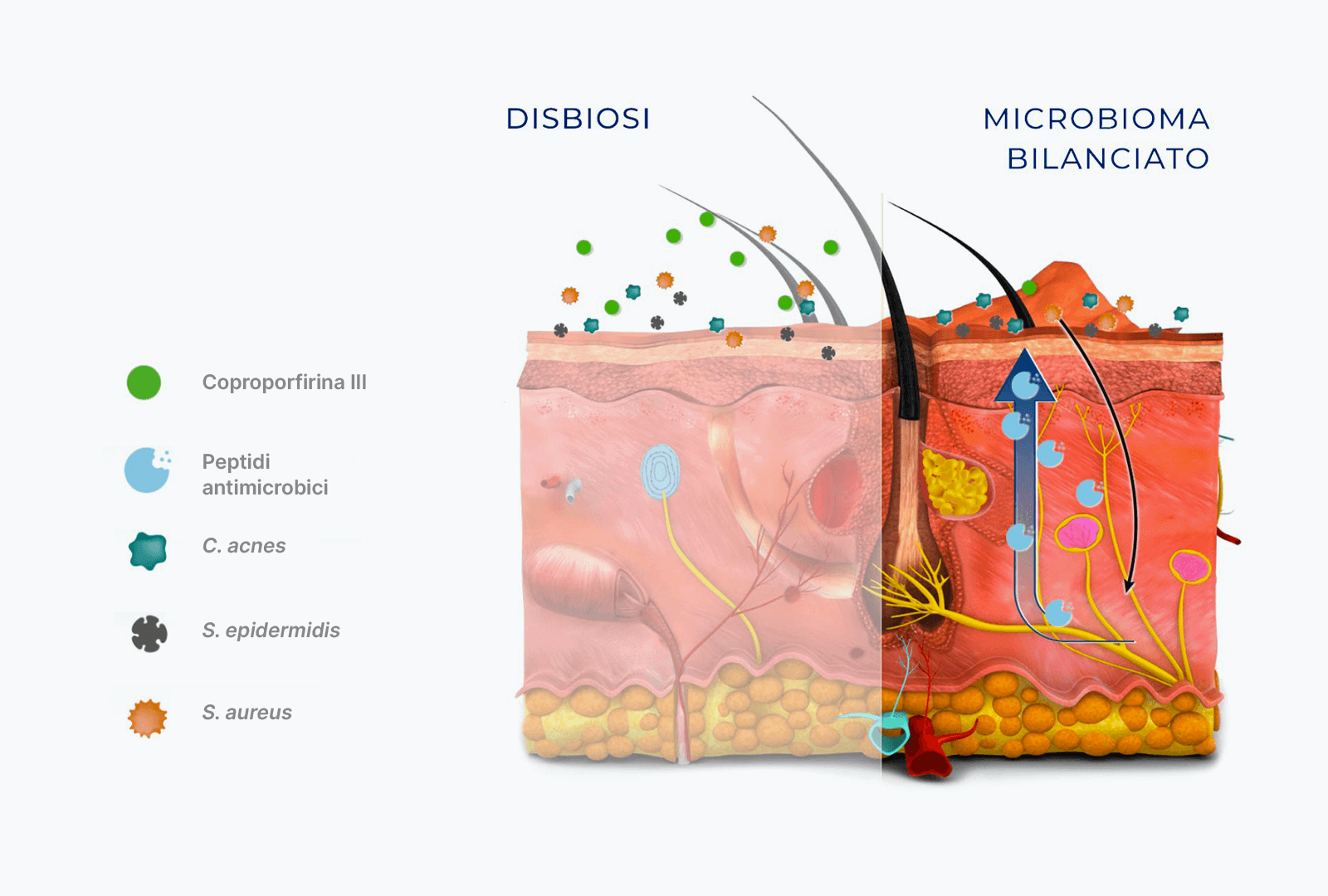 Immagine della pelle a confronto, con un microbioma bilanciato e una disbiosi 